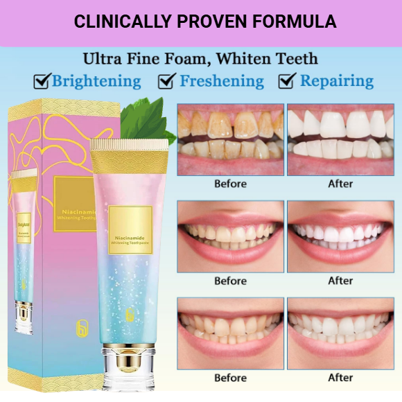 Whitening Toothpaste